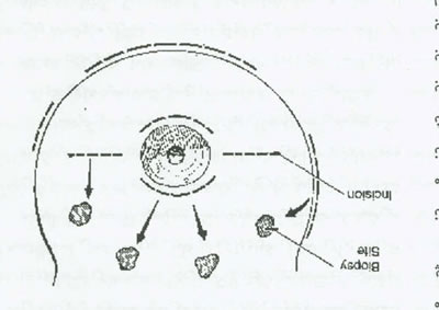 پستان وبيماريها و روشهاي درمان آن